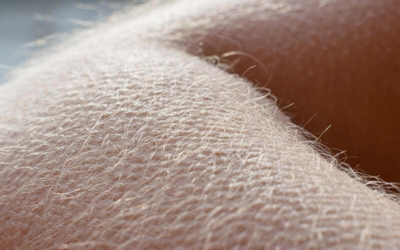 Goose bumps - human skin reaction on the cold